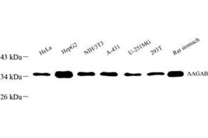 Western blot analysis of FLJ11506 (ABIN7073019) at dilution of 1: 1000 (AAGAB 抗体)