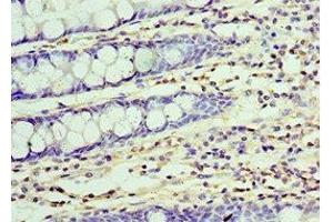 Immunohistochemistry of paraffin-embedded human colon tissue using ABIN7174370 at dilution of 1:100 (UCHL3 抗体  (C-Term))