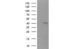 Image no. 2 for anti-Parvin, alpha (PARVA) antibody (ABIN1496443) (Parvin alpha 抗体)