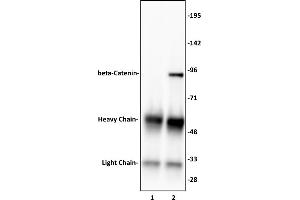 beta-Catenin antibody (pAb) tested by Immunoprecipitation. (beta Catenin 抗体  (N-Term))