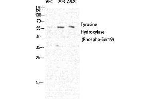 Western Blot (WB) analysis of specific cells using Phospho-TH (S19) Polyclonal Antibody. (TH 抗体  (pSer19))