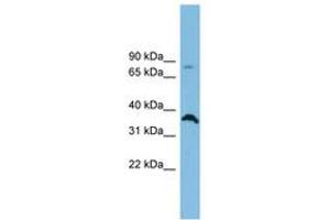 Image no. 1 for anti-Solute Carrier Family 6 (Neutral Amino Acid Transporter), Member 15 (SLC6A15) (AA 575-624) antibody (ABIN6744764)