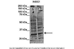 Lanes:   Lane1: 50 ug human putamen lysate Lane2: 50 ug rat cortex lysate  Primary Antibody Dilution:   1:1000  Secondary Antibody:   Mouse anti-rabbit HRP  Secondary Antibody Dilution:   1:15000  Gene Name:   INSIG1  Submitted by:   Anonymous (INSIG1 抗体  (Middle Region))