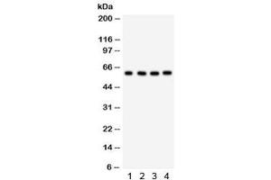 Western blot testing of 1) human placenta, 2) HepG2, 3) 293 and 4) HeLa lysate with HRPT2 antibody.