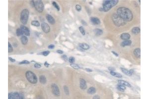 Immunohistochemistry (IHC) image for anti-V-Erb-A erythroblastic Leukemia Viral Oncogene Homolog 4 (Avian) (ERBB4) (AA 29-278) antibody (ABIN7440776)