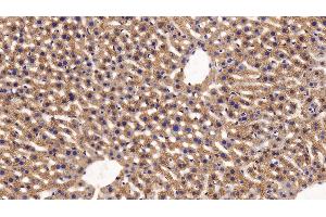 Detection of FUR in Mouse Liver Tissue using Polyclonal Antibody to Furin (FUR) (FURIN 抗体  (AA 418-573))