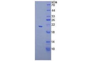 SDS-PAGE analysis of Mouse Apolipoprotein C3 Protein. (APOC3 蛋白)