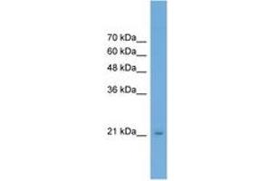 Image no. 1 for anti-RAB25, Member RAS Oncogene Family (RAB25) (AA 107-156) antibody (ABIN6746507) (RAB25 抗体  (AA 107-156))