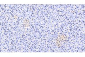 Detection of XRN1 in Human Pancreas Tissue using Polyclonal Antibody to 5'-3'Exoribonuclease 1 (XRN1) (XRN1 抗体  (AA 1394-1706))