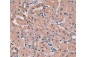 Used in DAB staining on fromalin fixed paraffin- embedded kidney tissue (PTPN13 抗体  (AA 1-161))