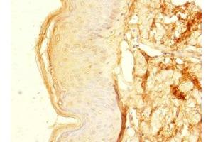 Immunohistochemistry of paraffin-embedded human skin tissue using ABIN7176351 at dilution of 1:100 (ZNF513 抗体  (AA 1-300))