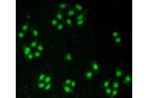 Detection of NUP50 in Hela cells using Polyclonal Antibody to Nucleoporin 50 kDa (NUP50) (NUP50 抗体  (AA 37-269))