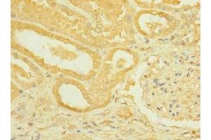 Immunohistochemistry of paraffin-embedded human kidney tissue using ABIN7168444 at dilution of 1:100 (ROBO2 抗体  (AA 450-660))
