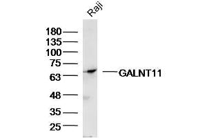 Raji Cell lysates probed with GALNT11/GalNAc-T11 Polyclonal Antibody, unconjugated  at 1:300 overnight at 4°C followed by a conjugated secondary antibody for 60 minutes at 37°C. (GALNT11 抗体  (AA 401-500))