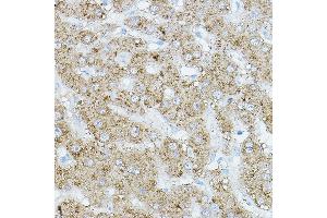 Immunohistochemistry of paraffin-embedded human liver using EIF2 Rabbit pAb (ABIN6131600, ABIN6140021, ABIN6140022 and ABIN6218371) at dilution of 1:500 (40x lens). (EIF2AK1 抗体  (AA 371-630))