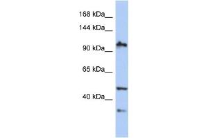 WB Suggested Anti-XAB2 Antibody Titration:  0. (XAB2 抗体  (N-Term))