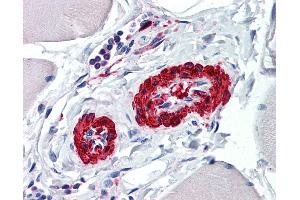 Immunohistochemistry (IHC) image for anti-Actin, alpha 2, Smooth Muscle, Aorta (ACTA2) (AA 1-378) antibody (ABIN790443)