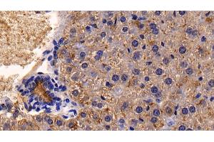 Detection of CD26 in Mouse Liver Tissue using Polyclonal Antibody to Cluster Of Differentiation 26 (CD26) (DPP4 抗体  (AA 631-760))