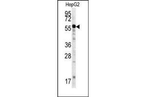 Image no. 1 for anti-Matrix Metalloproteinase 20 (MMP20) (Middle Region) antibody (ABIN358692) (MMP20 抗体  (Middle Region))
