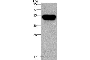 Western blot analysis of Hela cell, using CD160 Polyclonal Antibody at dilution of 1:250 (CD160 抗体)