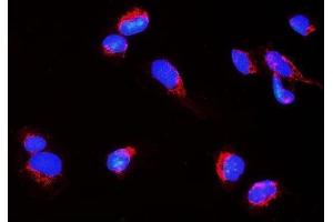 IF analysis of Nogo A/RTN4 using anti-Nogo A/RTN4 antibody (ABIN7603185).