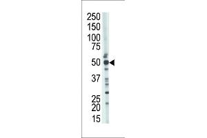 The anti-TSABIN486223 and ABIN1535604 Pab (ABIN388926 and ABIN2839200) is used in Western blot to detect TSABIN486223 and ABIN1535604 in mouse kidney tissue lysate. (TSG101 抗体  (N-Term))