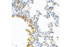 Immunohistochemistry of paraffin-embedded mouse lung using SERPINA3 antibody at dilution of 1:100 (40x lens).