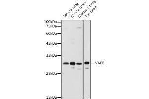 Western blot analysis of extracts of various cell lines, using VAPB antibody (ABIN6132783, ABIN6150058, ABIN6150059 and ABIN6221003) at 1:1000 dilution. (VAPB 抗体  (AA 10-222))