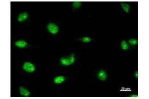 Immunostaining analysis in HeLa cells. (RPP30 抗体)