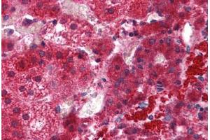 Human Adrenal: Formalin-Fixed, Paraffin-Embedded (FFPE) (EFHD1 抗体  (N-Term))
