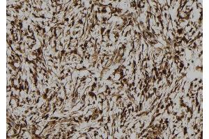ABIN6261026 and ABIN6273105 at 1/100 staining Human gastric tissue by IHC-P. (CREB3L1 抗体  (N-Term))