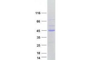 Western Blotting (WB) image for Forkhead Box I2 (FOXI2) protein (Myc-DYKDDDDK Tag) (ABIN2721359)
