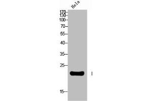 Western Blot analysis of HELA cells using Neurotensin Polyclonal Antibody (Neurotensin 抗体  (C-Term))