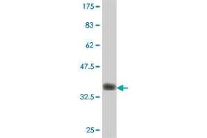 Western Blot detection against Immunogen (37. (RHBDL1 抗体  (AA 1-100))