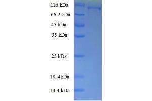 SDS-PAGE (SDS) image for 5-Methyltetrahydrofolate-Homocysteine Methyltransferase Reductase (MTRR) (AA 1-725), (full length) protein (GST tag) (ABIN5711940)