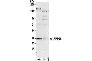 anti-Ribonuclease P/MRP 25kDa Subunit (RPP25) (AA 149-199) antibody