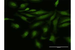 Immunofluorescence of purified MaxPab antibody to NFATC4 on HeLa cell. (NFATC4 抗体  (AA 1-902))