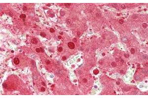 Immunohistochemistry (IHC) image for anti-Alanine Aminotransferase (ALT) (AA 367-480) antibody (ABIN7429409)