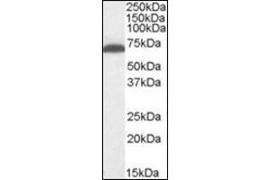 Antibody (1 µg/ml) staining of Mouse Brain lysate (35 µg protein in RIPA buffer). (GAD 抗体  (Internal Region))