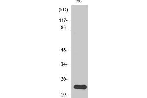 Western Blotting (WB) image for anti-N/H/K-Ras antibody (ABIN5956741) (N/H/K-Ras 抗体)