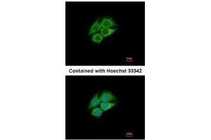 ICC/IF Image Immunofluorescence analysis of methanol-fixed Hep G2, using PANK1, antibody at 1:500 dilution. (PANK1 抗体)