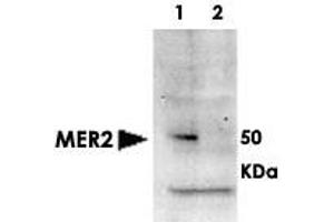 Western blot using MER2 (phospho S30) polyclonal antibody  shows detection of phosphorylated MER2 in whole cell extracts. (CD151 抗体  (pSer30))