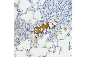 Immunohistochemistry (IHC) image for anti-Complement Factor B (CFB) (AA 80-420) antibody (ABIN3015550)