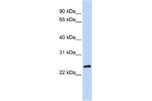 WB Suggested Anti-MLX Antibody Titration: 0. (MLX 抗体  (N-Term))