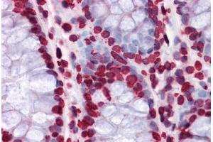 Human Colon: Formalin-Fixed, Paraffin-Embedded (FFPE) (HIPK1 抗体  (AA 330-430))