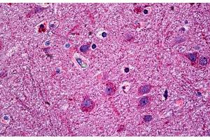 Human Brain, Cortex: Formalin-Fixed, Paraffin-Embedded (FFPE) (Neurotrimin 抗体  (AA 235-284))