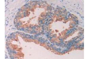 IHC-P analysis of Human Prostate Gland Tissue, with DAB staining. (SERPINA6 抗体  (AA 218-378))