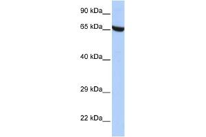 WB Suggested Anti-ZNF528 Antibody Titration:  0.