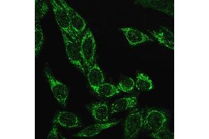Immunofluorescence Analysis of PFA fixed HeLa cells labeling Cytochrome C Recombinant Rabbit Monoclonal Antibody (CYCS/3128R) followed by Goat anti-rabbit IgG-CF488 (Green) (Recombinant Cytochrome C 抗体)