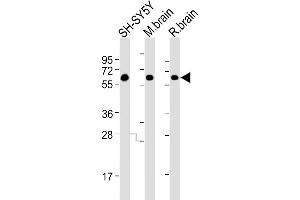 All lanes : Anti-DPYL5 Antibody at 1:4000 dilution Lane 1: SH-SY5Y whole cell lysates Lane 2: mouse brain lysates Lane 3: rat brain lysates Lysates/proteins at 20 μg per lane. (DPYSL5 抗体)